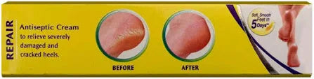 Foot Cream