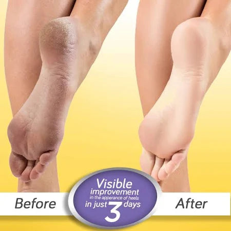 Foot Cream